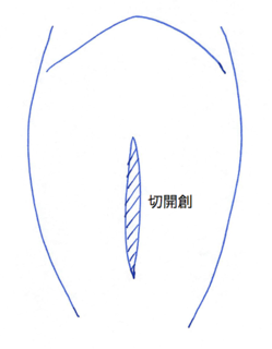 スクリーンショット 2017-02-26 3.47.32.png